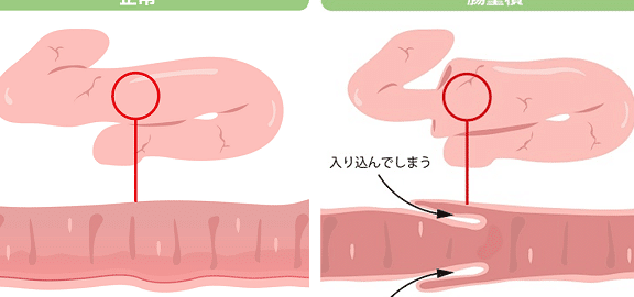 猫の腸閉塞余命!原因と症状、治療法 5 e78cabe381aee885b8e99689e5a19ee4bd99e591bdefbc81e58e9fe59ba0e381a8e79787e78ab6e38081e6b2bbe79982e6b395